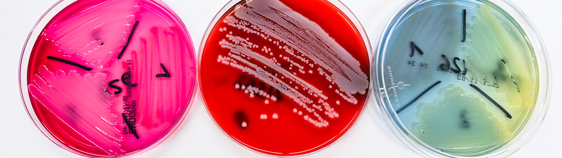 Drei Proben für Labor Pathologie und Mikrobiologie (durchsichtige Dosen mit Proben in pink, rot und blau/grün)