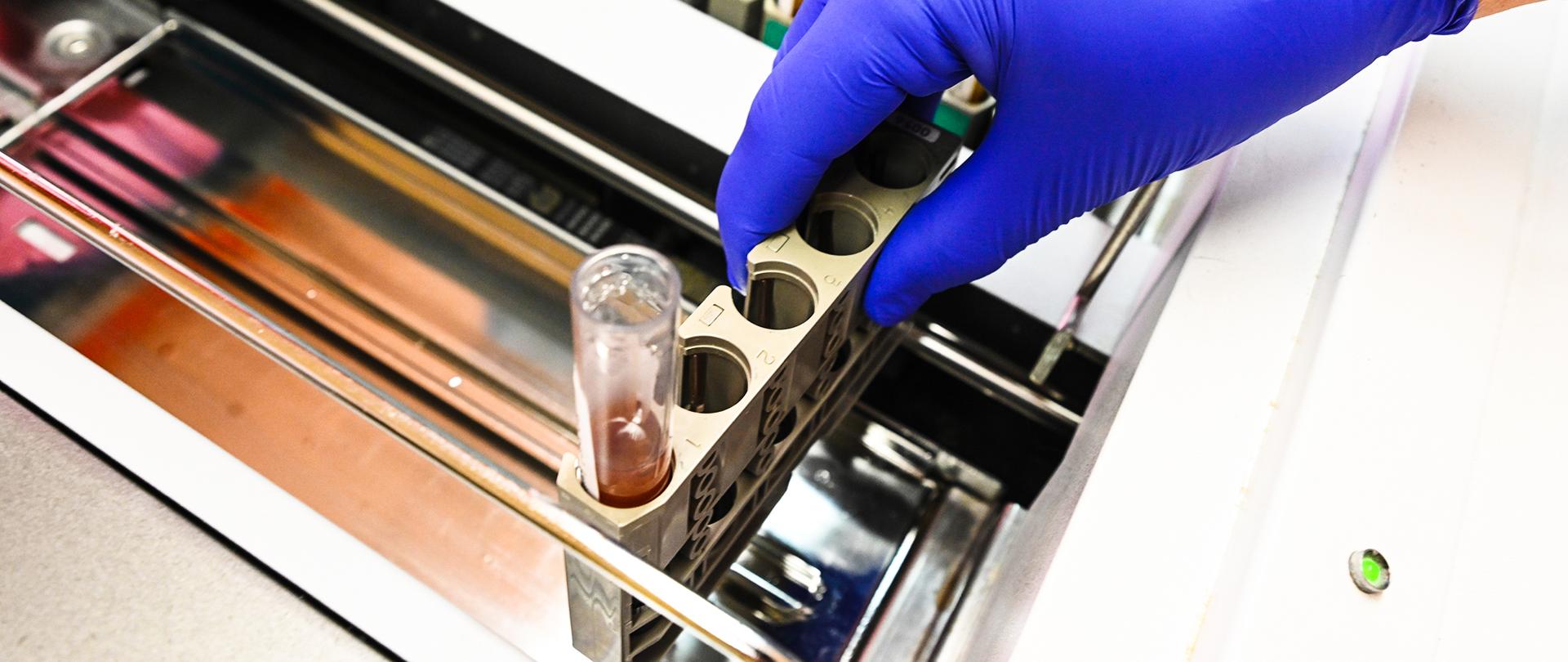 Gerät in medizinisch-chemische Labordiagnostik, rechte Hand mit blauem Gummihandschuh und Glasröhrchen